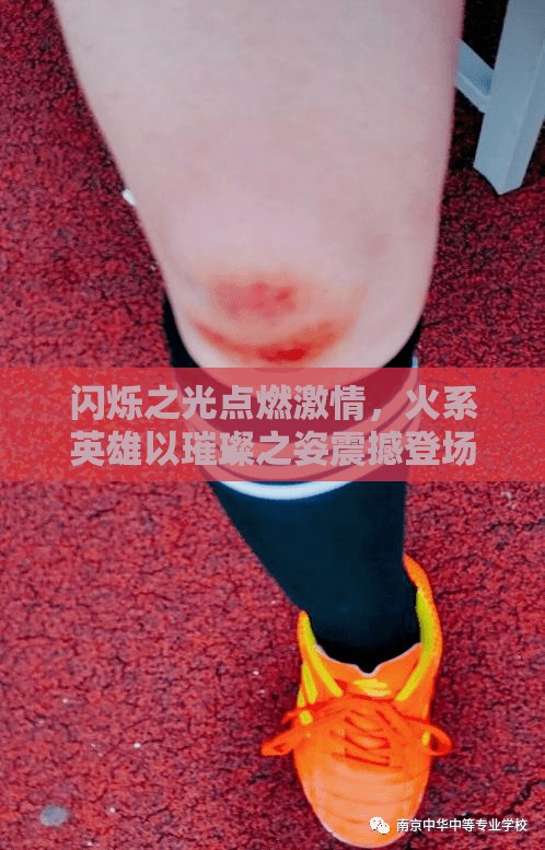 闪烁之光点燃激情，火系英雄以璀璨之姿震撼登场