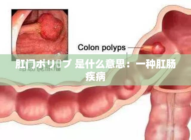 肛门ポリープ 是什么意思：一种肛肠疾病