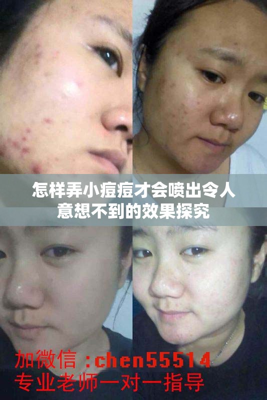 怎样弄小痘痘才会喷出令人意想不到的效果探究