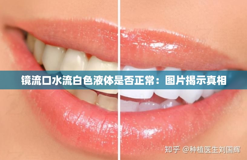 镜流口水流白色液体是否正常：图片揭示真相
