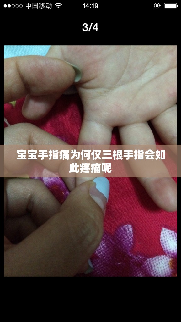 宝宝手指痛为何仅三根手指会如此疼痛呢