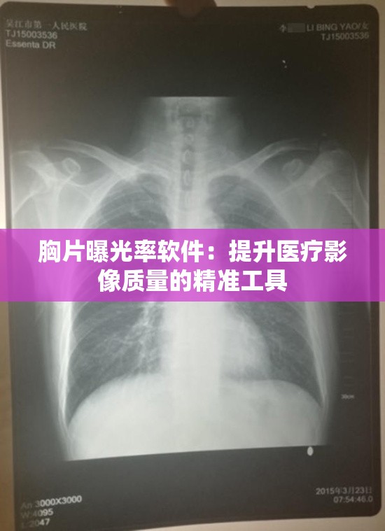 胸片曝光率软件：提升医疗影像质量的精准工具