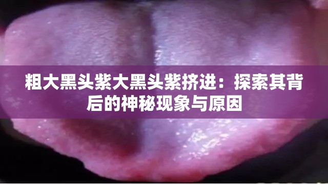 粗大黑头紫大黑头紫挤进：探索其背后的神秘现象与原因