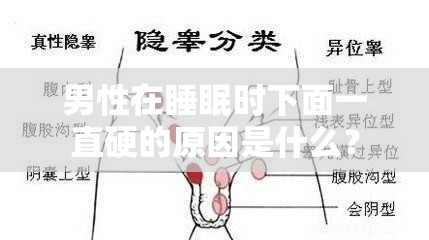 男性在睡眠时下面一直硬的原因是什么？